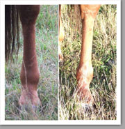 swollen legs from salt deficiency